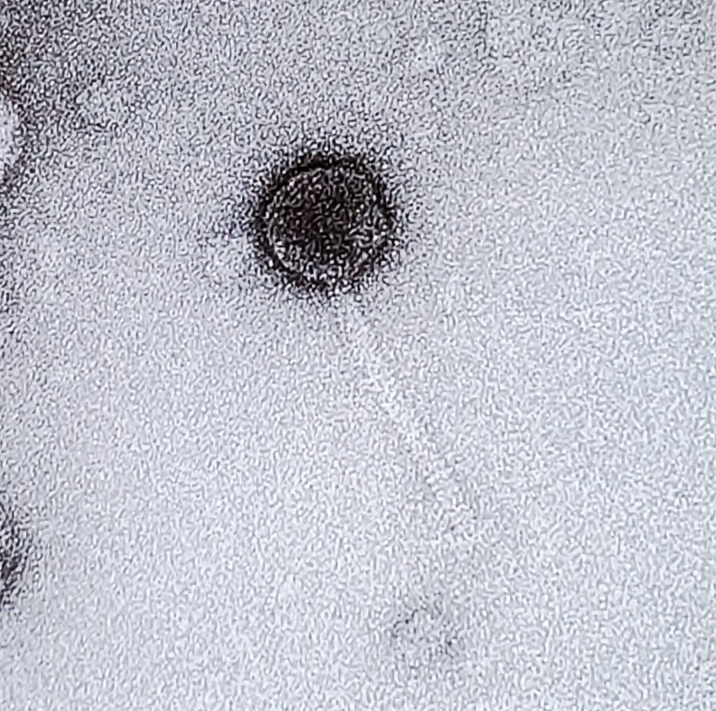 An electron micrograph of a phage virus.