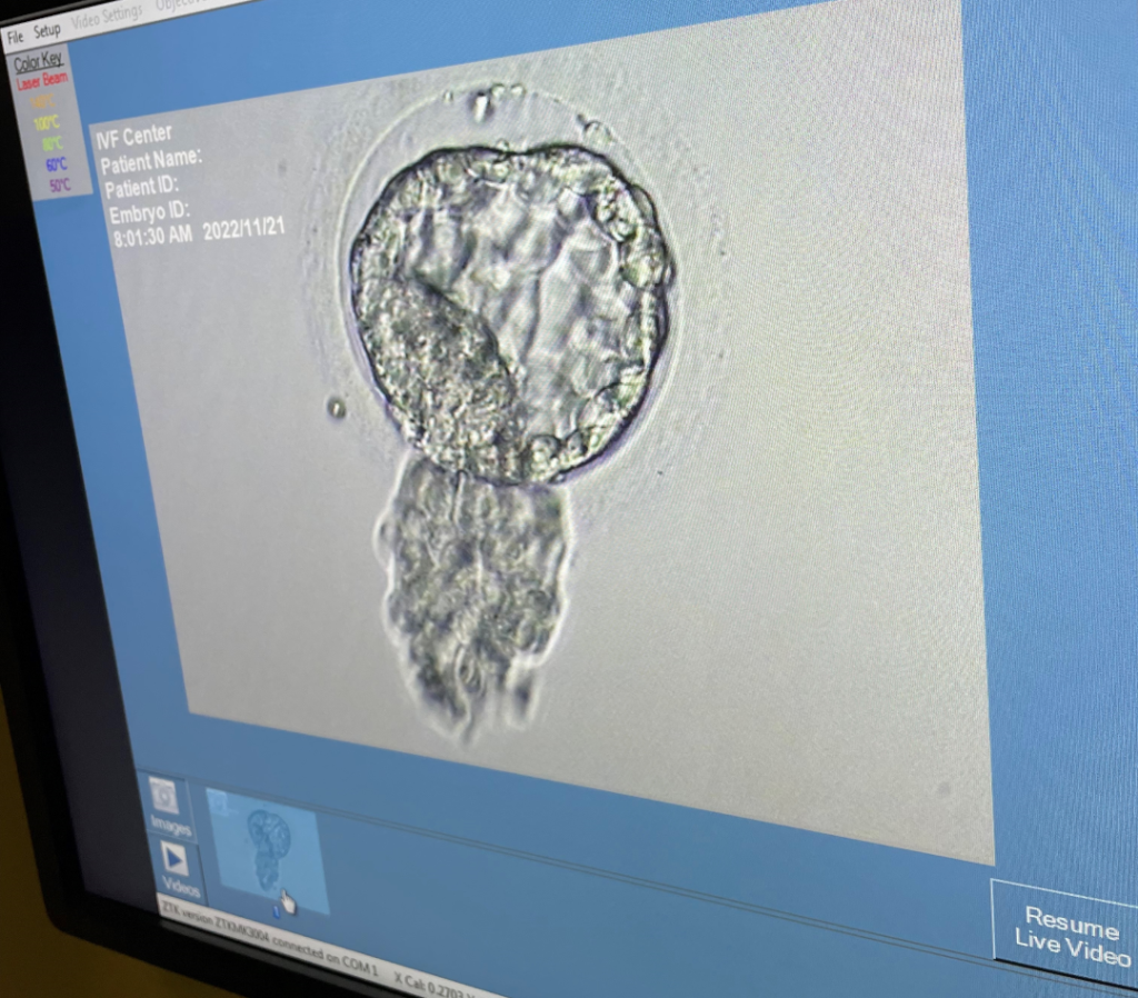 Image of an embryo on a computer screen.